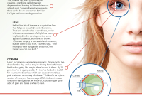 Sunglasses Benefits For Eyes